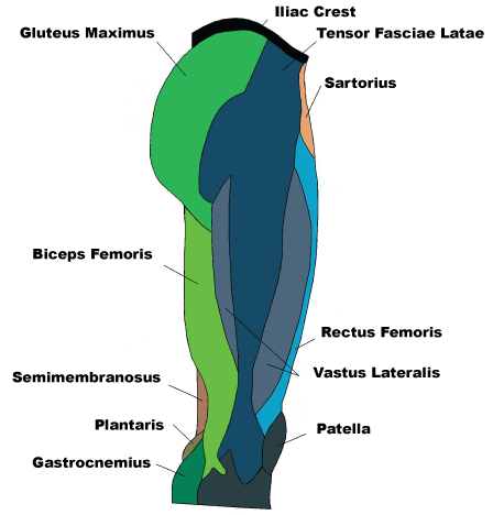 it band syndrome treatment