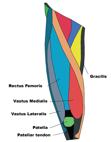 patellar tendintis treatment