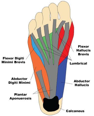 plantar fasciitis alternative treatment